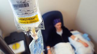 Женщина лечится химиотерапией
