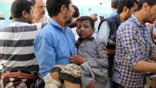 A Yemeni man holds a boy injured in an air strike in Saada (9 August 2018)