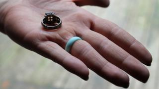 El anillo de bodas de Casey perdió el color debido al nivel de contaminación del agua en su casa.