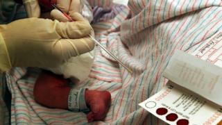 Profesional de la salud extrayendo sangre de un bebé