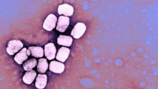Virus de la viruela