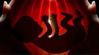 ගබ්සාව