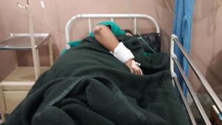 घाइते बांग्लादेशी महिला