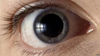 Eye