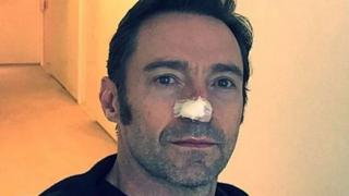 Hugh Jackman