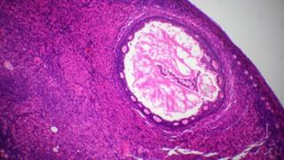   A section of the ovary under a microscope 