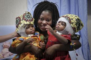 A smiling woman holds two infants, one in each arm, whose heads are bandaged following surgey.