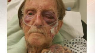 Arthur Gumbley in hospital