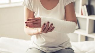 Mujer con brazo en escayola
