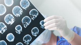 radiografia cerebral