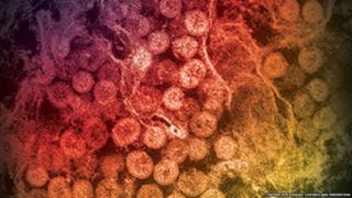 Saudi Arabia sees Mers deaths surge - BBC News