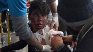 A wounded boy with blood on his face being bandaged by medical staff