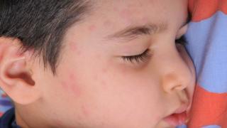 Niño enfermo