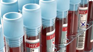 Test tube for HIV