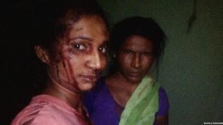 वाघाच्या हल्ल्यानंतर रुपालीने घेतलेला सेल्फी