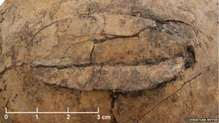 Cranial fracture in a 3-5-year-old child from the Neolithic mass grave of Schöneck-Kilianstädten