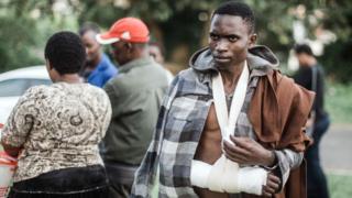 Foreigner wey wunjure for xenophobic attack