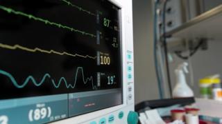 Cardiac surgery equipment