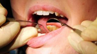 Фото из файла: Крупный план стоматолога, осматривающего зубы пациента