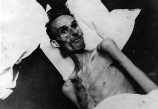 Víctima de 37 años del Invierno del Hambre, en una camilla en 1944.