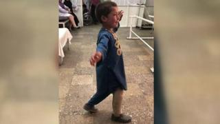 طفل أفغاني يرقص بساق اصطناعية