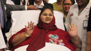 Eman Ahmed Abd El Aty postrada en una cama