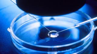 A photo of the sperm selection process in IVF