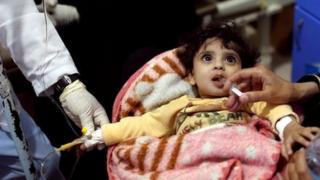 Woman gives her daughter rehydration fluid at a cholera treatment centre in Sanaa, Yemen May 15, 2017