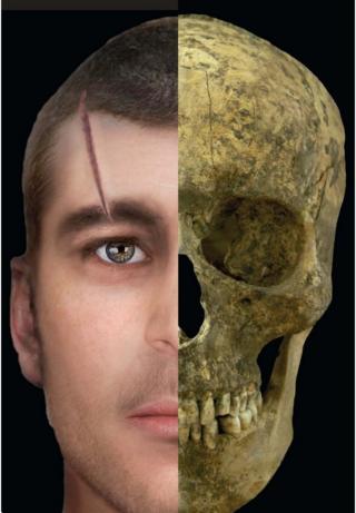 Face and skull