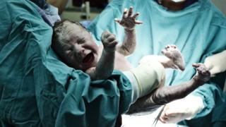 Foto genérica de un bebé