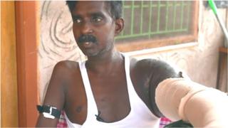 కిడ్నీ వ్యాధి బాధితుడు