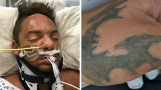 Man in hospital and hand tattoo