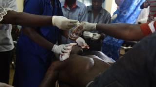 Aworan okunrin to n gba itọju ni ile iwosan Kenya.