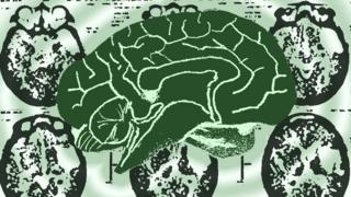 Brain graphic