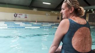 A britânica Sylvia Mac sentada à beira de uma piscina em Londres