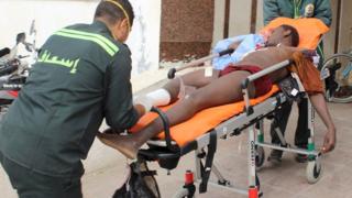 An African migrant, who was wounded during gunfire near the border with Israel, lies on a stretcher as he is taken to the hospital at Al Arish city, in the northern part of Sinai peninsula.