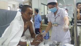 Một nạn nhân từ đám cháy đang được điều trị tại bệnh viện hôm 23/3