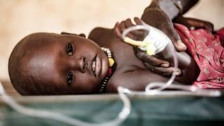 One year-old Hakaroom is treated for severe pneumonia at a health care centre supported by Save the Children in Kapoeta North, South Sudan.