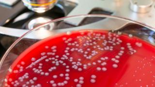 A Petri dish showing a growth of bacteria next to a microscope