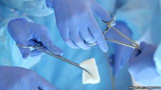 surgery