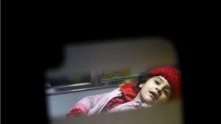 Suriye'de tahliye edilen hasta çocuklar