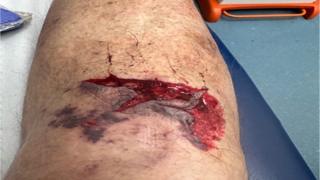 Injured leg