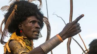 circumcision HIV