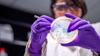 Drug-resistant superbug spreading in Europe’s hospitals