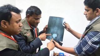 যাত্রীর পেটের এক্স-রে, ভেতরে সন্দেহজনক বস্তু