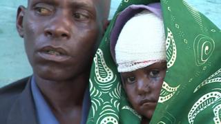 "Eu vi eles cortando ela com um facão": a tragédia humanitária em meio a conflito no Congo