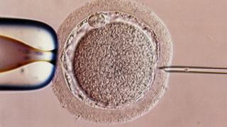 IVF