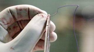 preparing a suture for surgery
