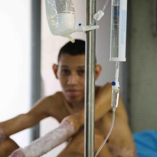 Paciente com queimadura