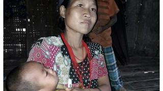 နာဂဒေသက အမိရင်ခွင်ထဲ ဝေဒနာခံစားနေရတဲ့ကလေးငယ်